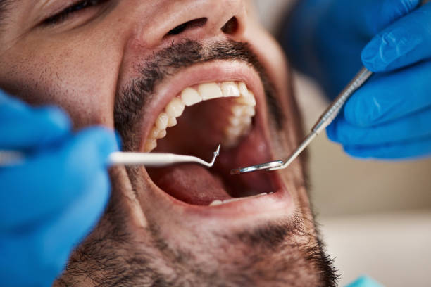 Best Emergency Treatment for Dental Infections or Abscesses in Copiague, NY